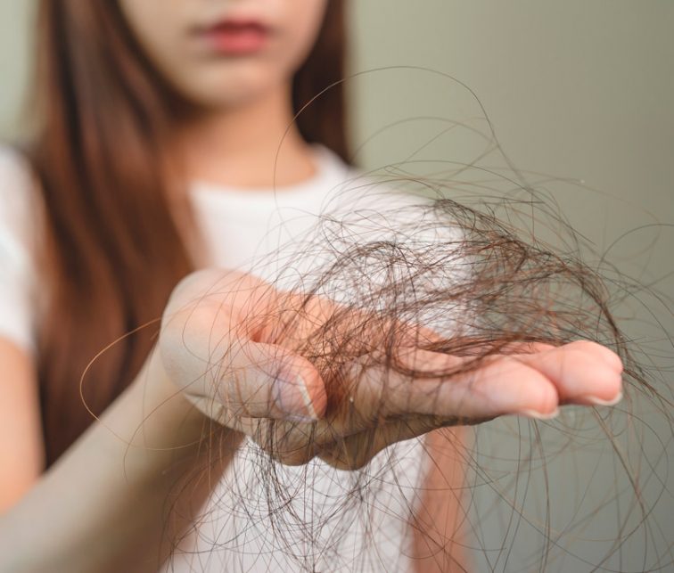nuevo estudio sobre la caida del cabello